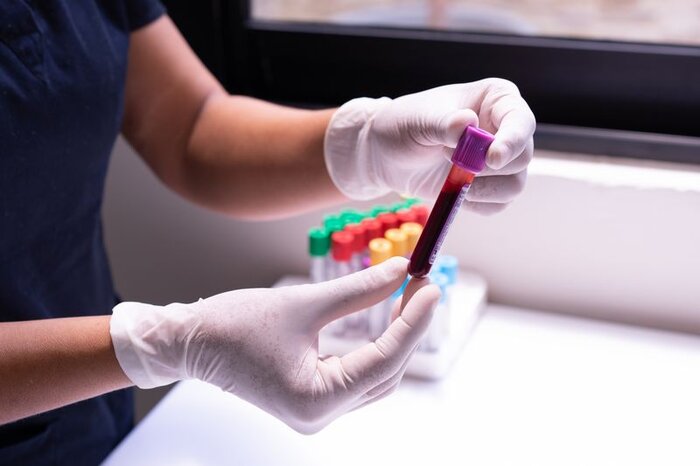 Analyses de laboratoire